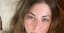 Vanderpump Rules' Stassi Schroeder Shows Off Her Facial Psoriasis in Makeup-Free Selfie: 'It's a Mood'