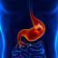 6 Warning Signs of Stomach Cancer