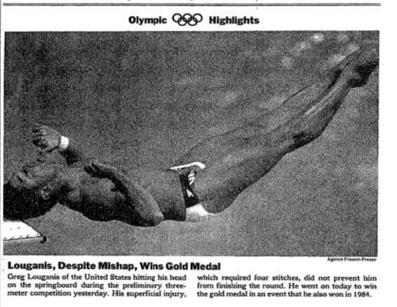At the Seoul Olympics today in 1988, U.S. diver Greg Louganis hit his head on the springboard so badly he needed stitches. However, he finished the round and went on to win the gold medal.