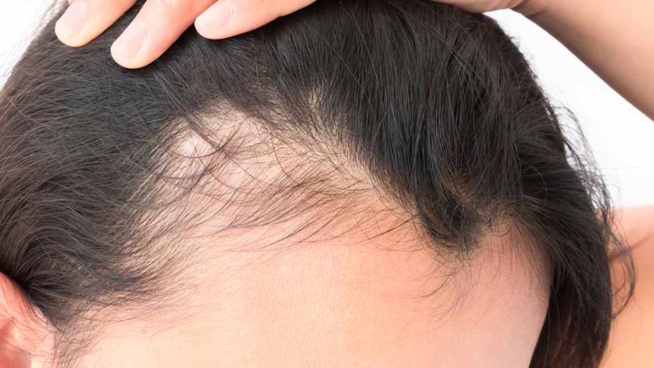 Mix The One Thinning Hair Vitamin Every Woman Over 40 Should