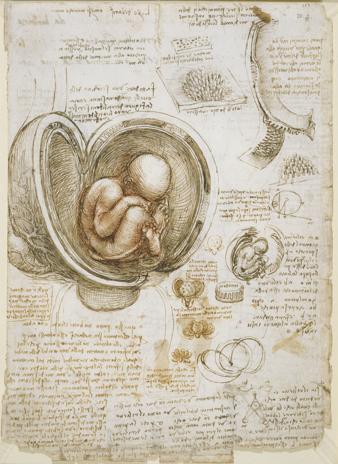 Part one of Da Vinci's "Studies of the Fetus in the Womb", ca. 1511, which correctly depicts a human fetus in a breech position inside a dissected uterus.