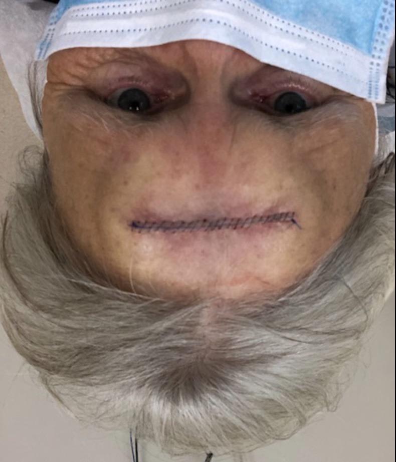 PsBattle: This woman who had skin surgery who sent her child a picture of her upside down