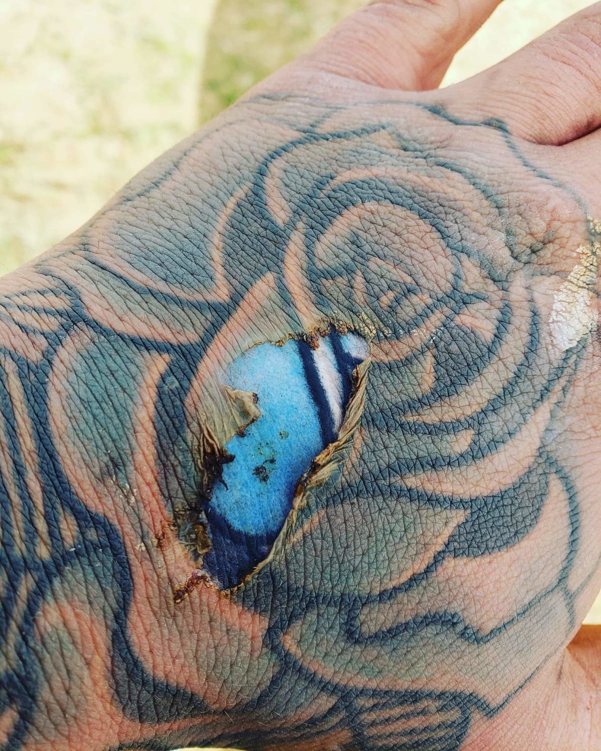 Burn caused beautiful tattoo color reveal.