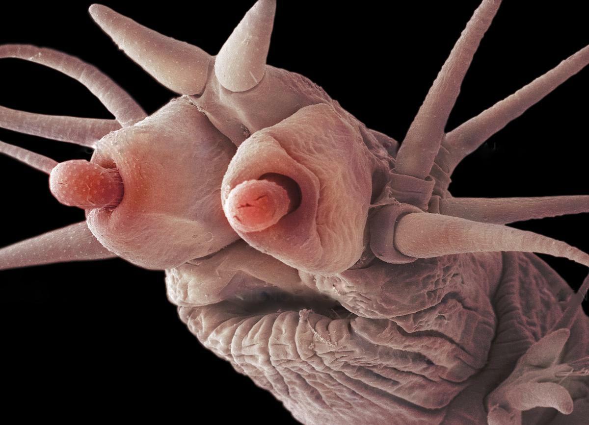 PsBattle: a deep ocean worm under an electron microscope