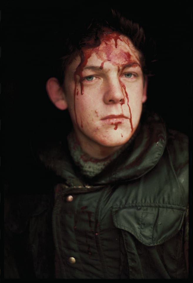 A British soldier hit by an IRA sniper while on patrol in County Fermanagh along the border on January 28, 1978.