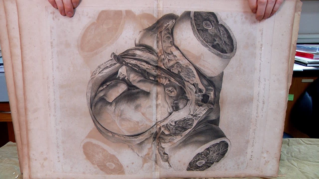 Mütter Minute: The Gravid Uterus, 1774