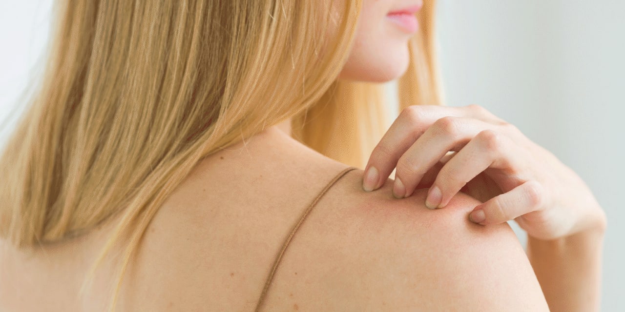 How to Tell the Difference Between Psoriasis and Eczema