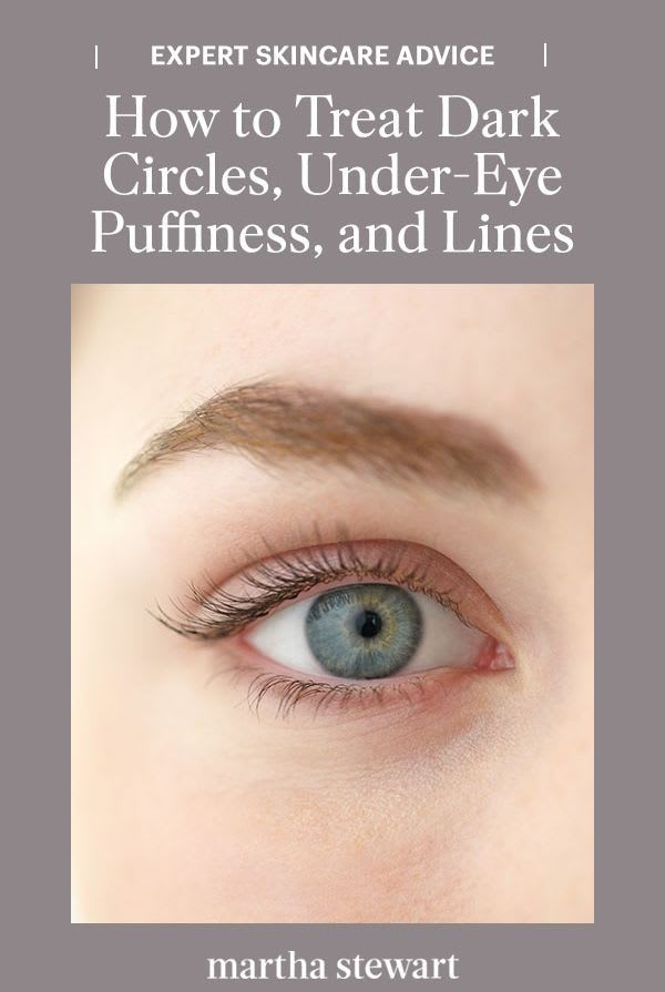How to Treat Dark Circles, Under-Eye Puffiness, and Lines