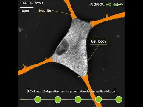Morphological evolution of cortical neuron cells over time - live!