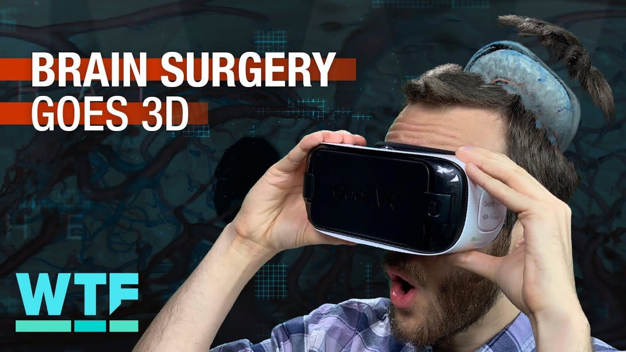 Brain surgery goes 3D | What The Future